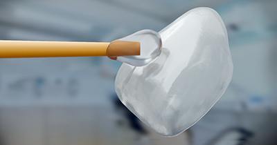 a close-up of a dental veneer