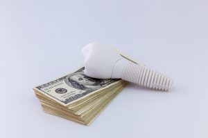 dental implant on money