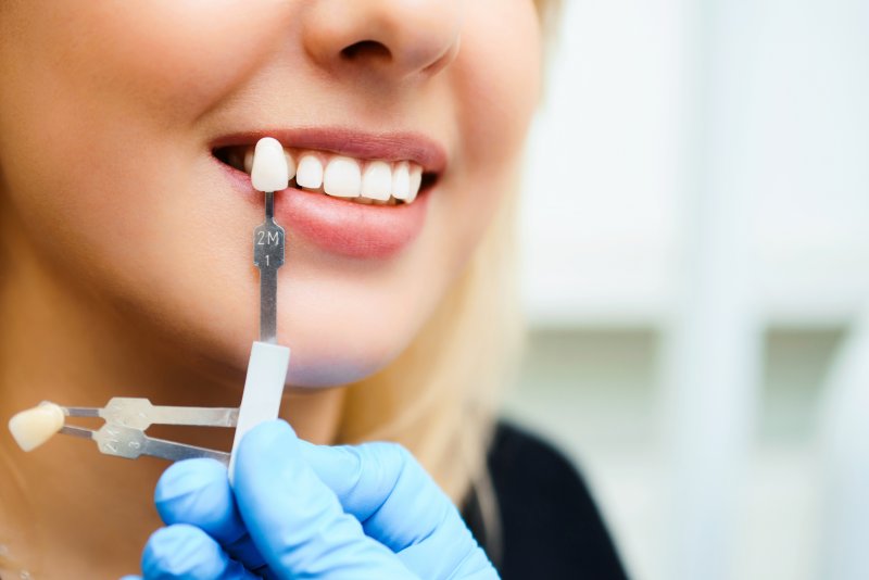 Close-up of dental implant model compared to patient’s natural smile